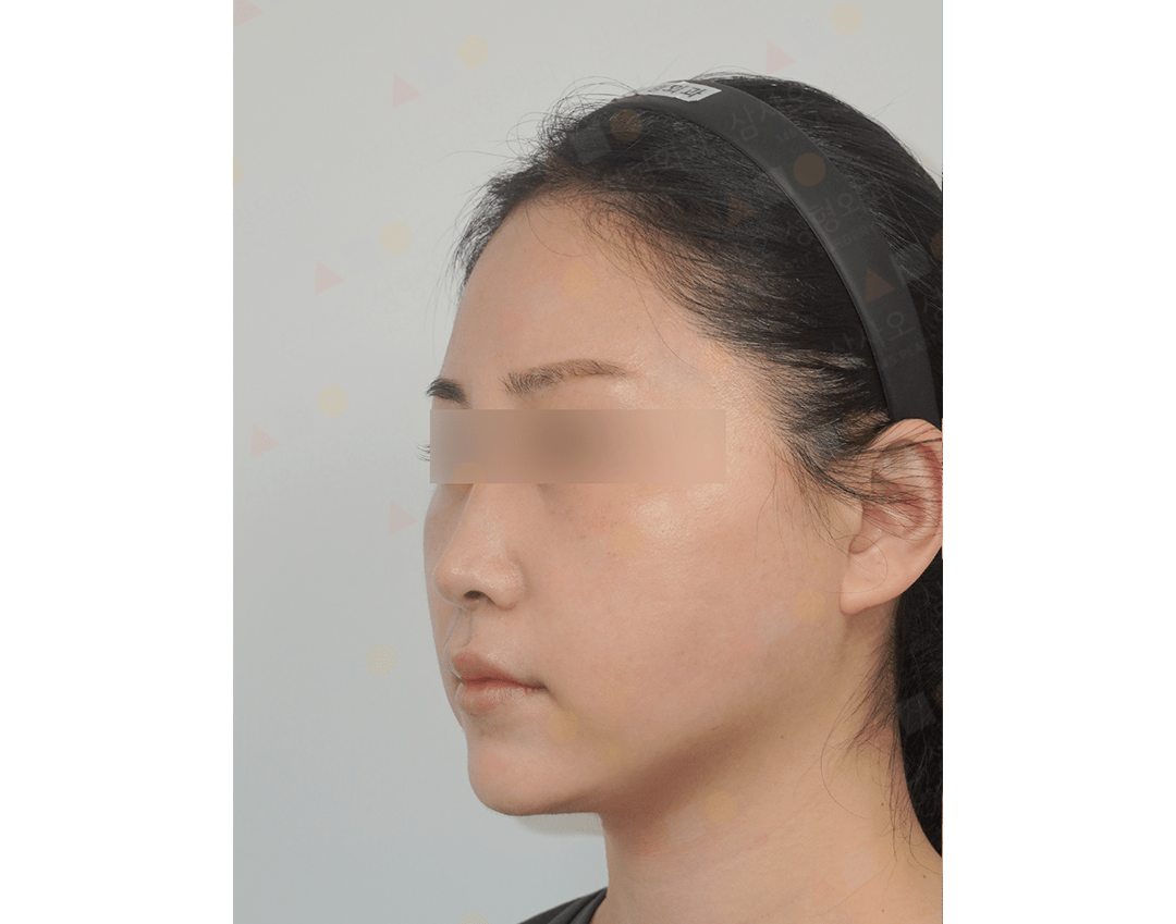 Profile view of person wearing headband.