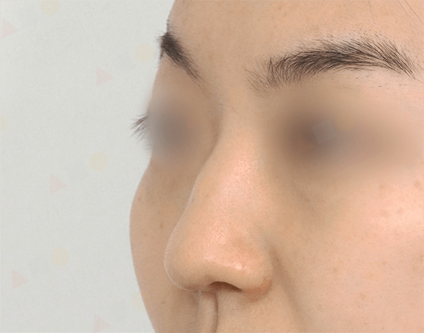 Close-up side view of a person's nose