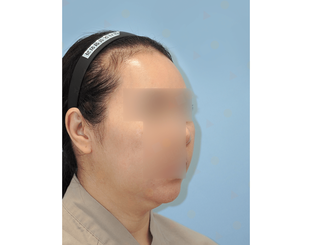 Side view of blurred face wearing headband.