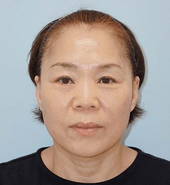 Person with short hair against blue background