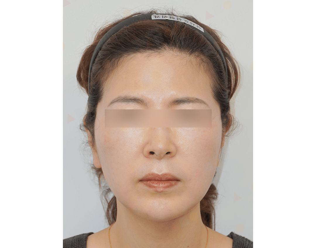 Woman with blurred eyes, wearing a headband.