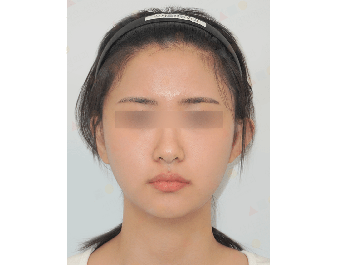 Woman's face with headband, blurred eyes.