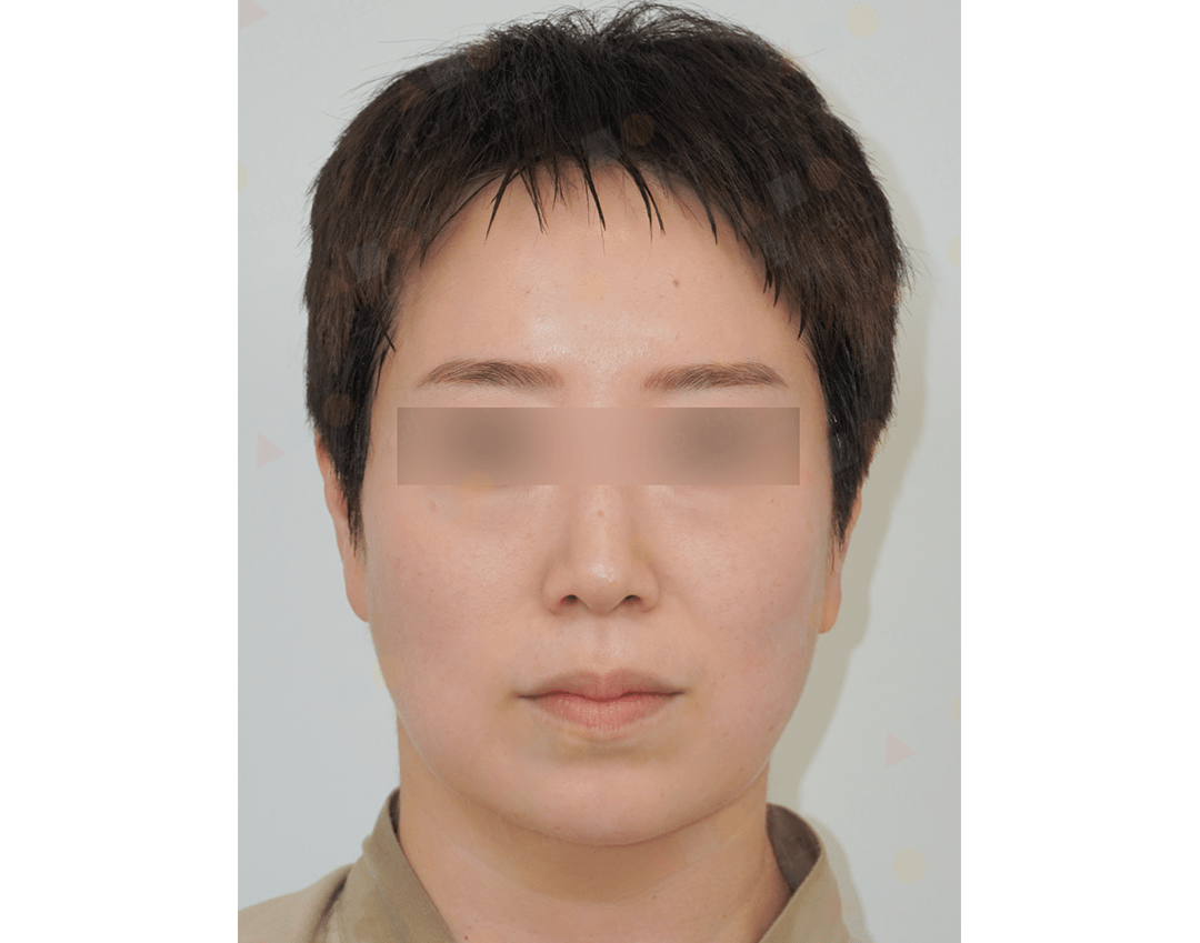 Person with short hair and blurred eyes