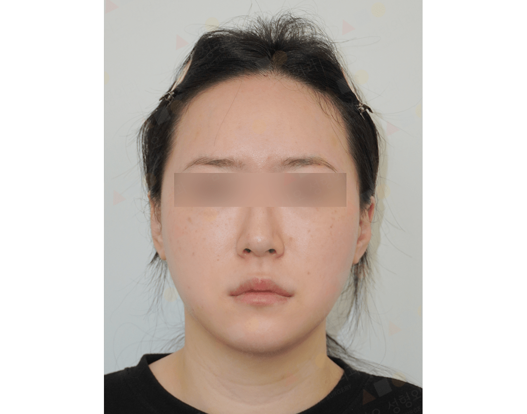 Close-up portrait of a person with blurred eyes.