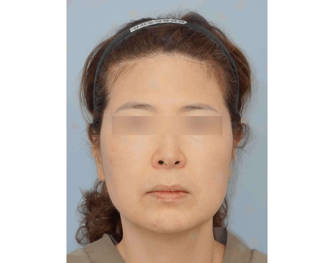 Woman with headband, blurred eyes, neutral expression.