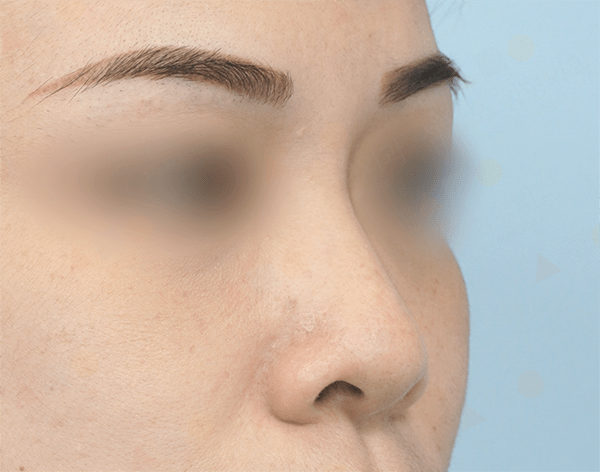 Close-up of a person's eyebrow and nose.